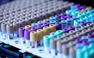 920 cases of acute hepatitis of unknown etiology in children recorded worldwide