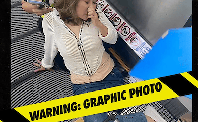 A conveyor belt chewed up a woman's leg at an airport in Thailand. Medics performed an amputation on the spot