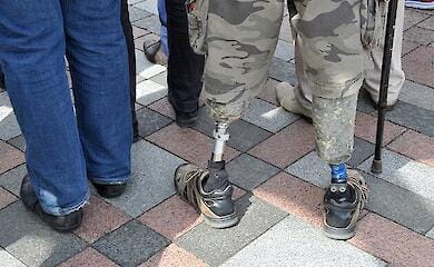 Up to 50 thousand Ukrainians lost one or more limbs since the beginning of the full-scale war 