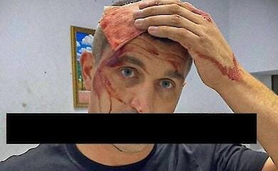 A Russian politician and activist was hit on the head with a crowbar in Mariupol 