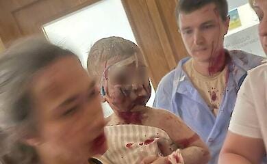 Part of Ukraine's main children's hospital collapsed due to Russian shelling