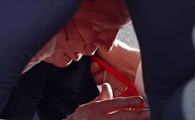 It's become known how Trump feels after the attack