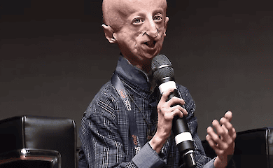 Sammy Basso, the biologist who lived the longest with progeria, has passed away