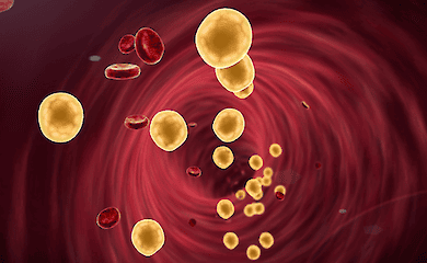 Novel technology has 'frozen' bad cholesterol: a breakthrough in preventing heart attacks and strokes