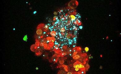 Scientists have found a way to make luminal breast cancer vulnerable to the immune system