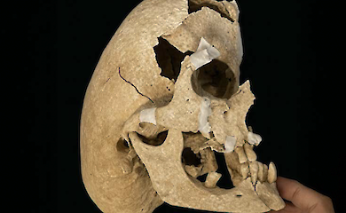 He was considered an excavation mystery - now it's clear what ailed this medieval knight