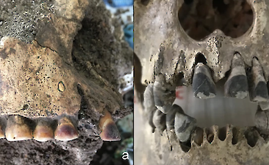 Archaeologists have found out what was used to blacken teeth in ancient Vietnam