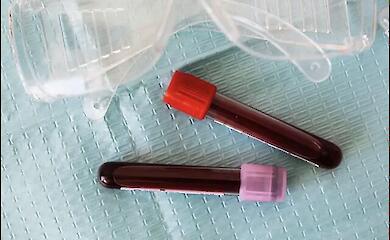 Blood sample tube for cardiovascular risk analysis