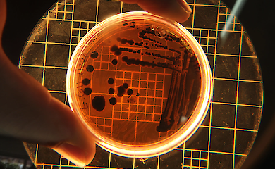 Microorganisms able to survive in extreme conditions under the microscope