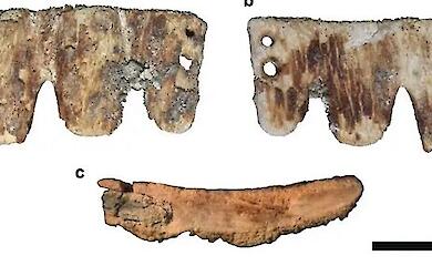 A dental bridge made of bone from the 18th and 19th century has been found in Porto