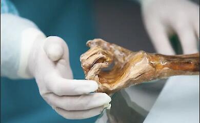 Etsy's ice mummy turns out to be home to ancient and modern microbes