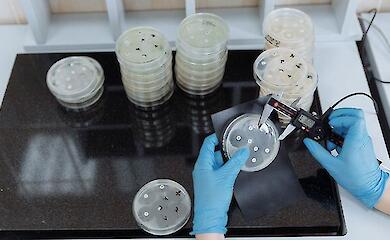 Copper against drug-resistant bacteria: scientists are studying the body’s defences
